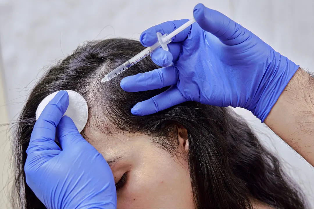 topical treatment for thinning hair