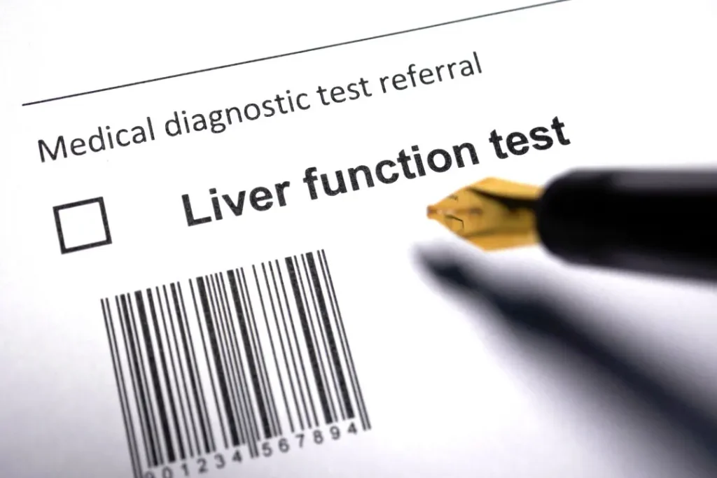 Liver function test. 
