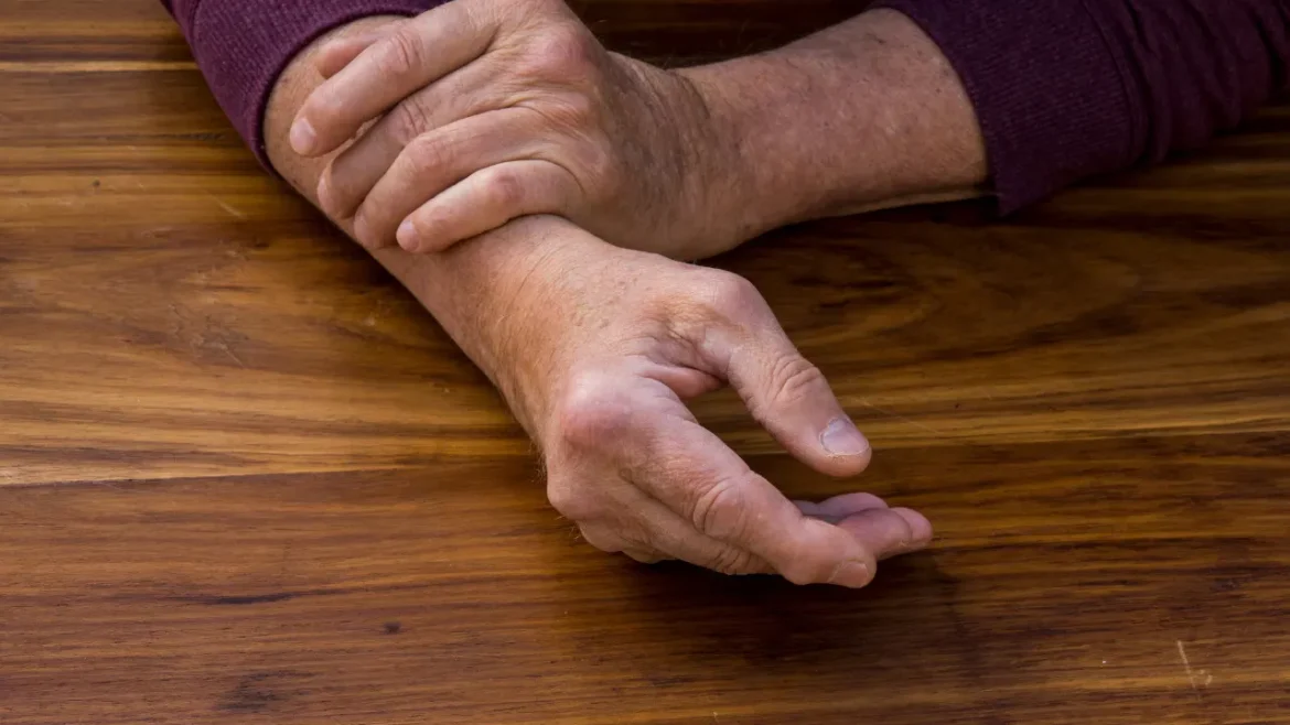 Psoriatic arthritis.